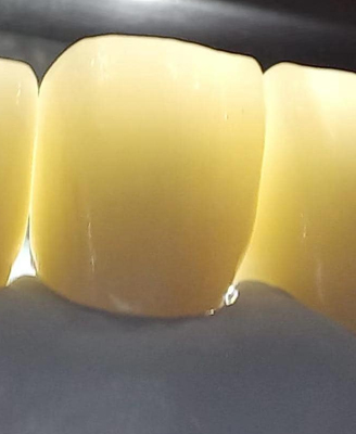 Multilayer zirconia block