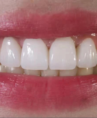 Multilayer zirconia block