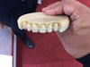 CAD CAM Dental Monolayer Multlayer PMMA Block 